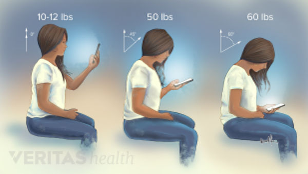 Nerd Neck Illustration Head Position Cellphone Use